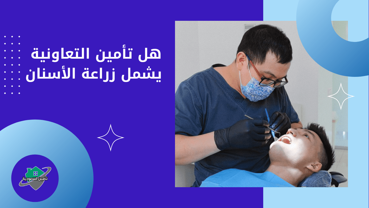 هل تأمين التعاونية يشمل زراعة الأسنان